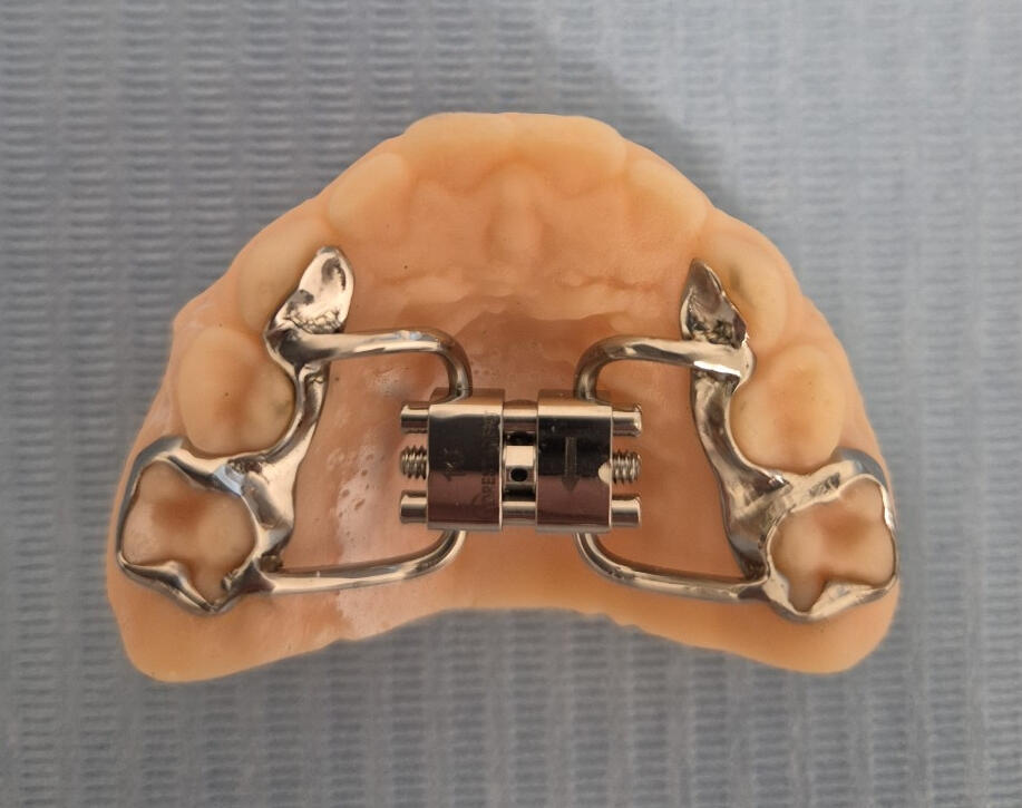 disjoncteur maxillaire bagues anatomiques