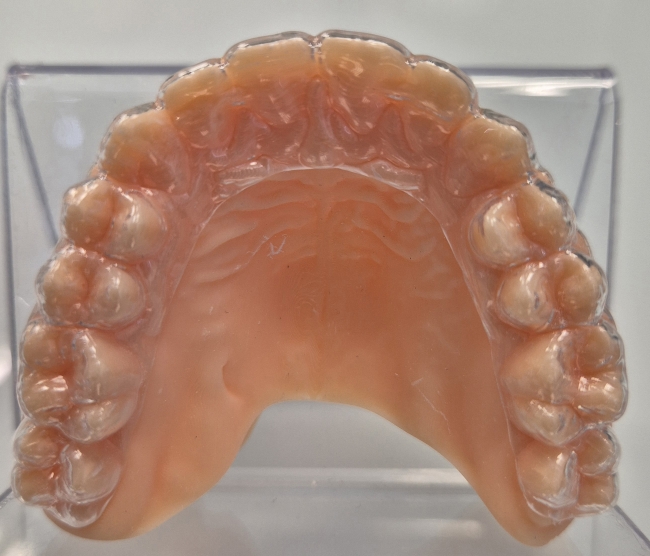 gouttière contention port nocturne