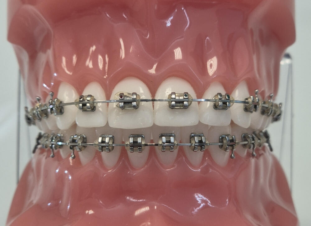 multiattache métallique