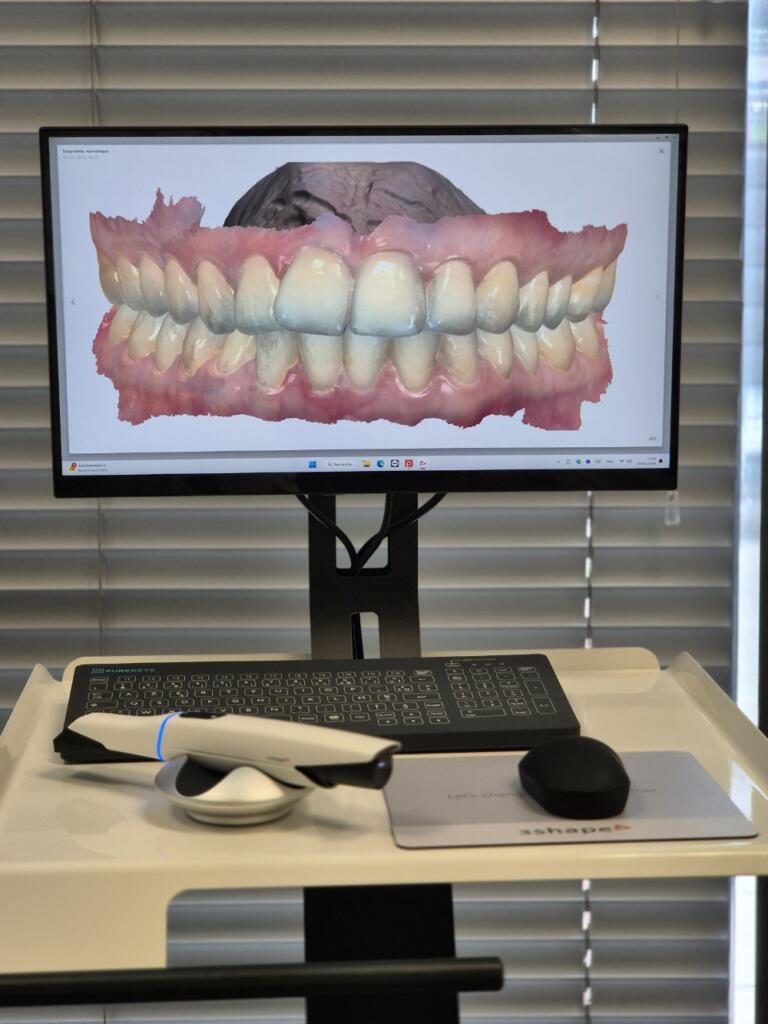 scanner intraoral 3shape empreintes numériques